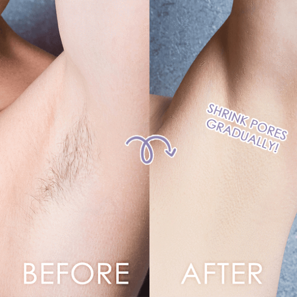 BodyGlow Ηλεκτρική Ξυριστική Συσκευή