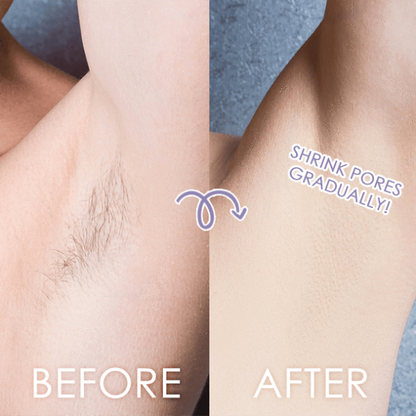 BodyGlow Ηλεκτρική Ξυριστική Συσκευή