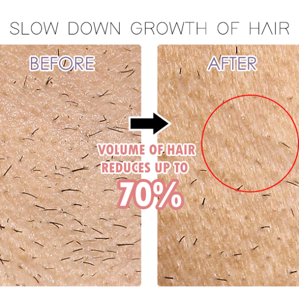 BodyGlow Ηλεκτρική Ξυριστική Συσκευή