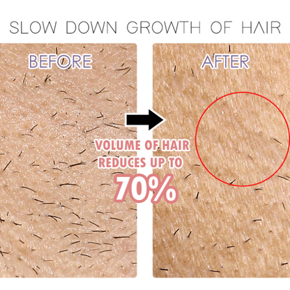 BodyGlow Ηλεκτρική Ξυριστική Συσκευή