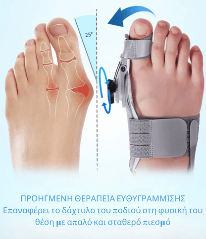 Νάρθηκας Hallux Valgus