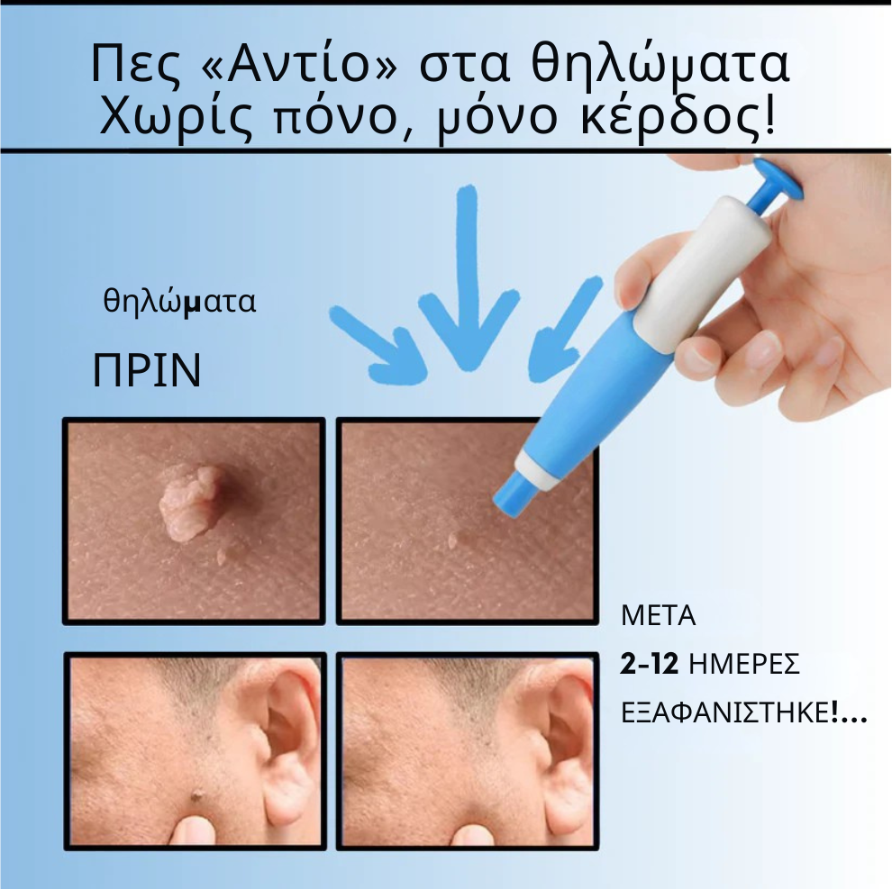 TagOFF Kit – Τέλος στα Θηλώματα Δέρματος